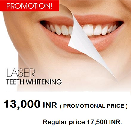 Tooth Whitening Promo