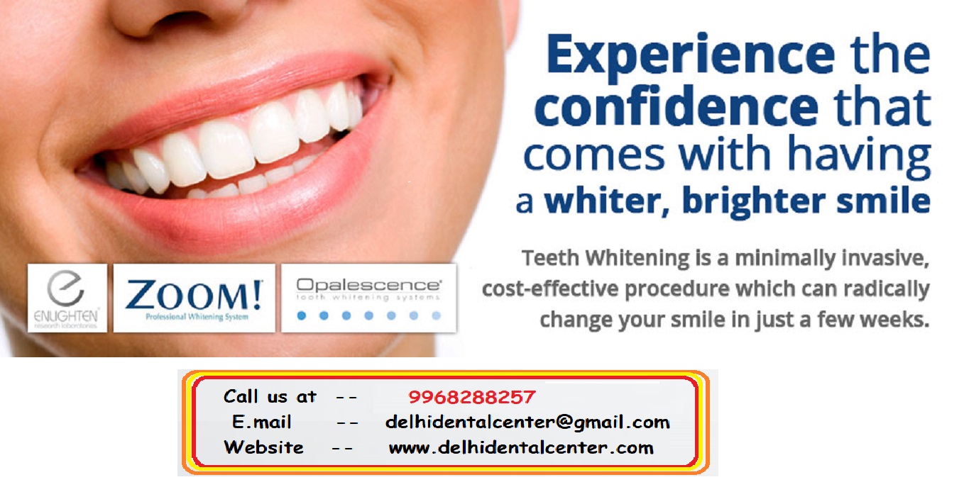 Tooth Whitening Dentist in Shakarpur