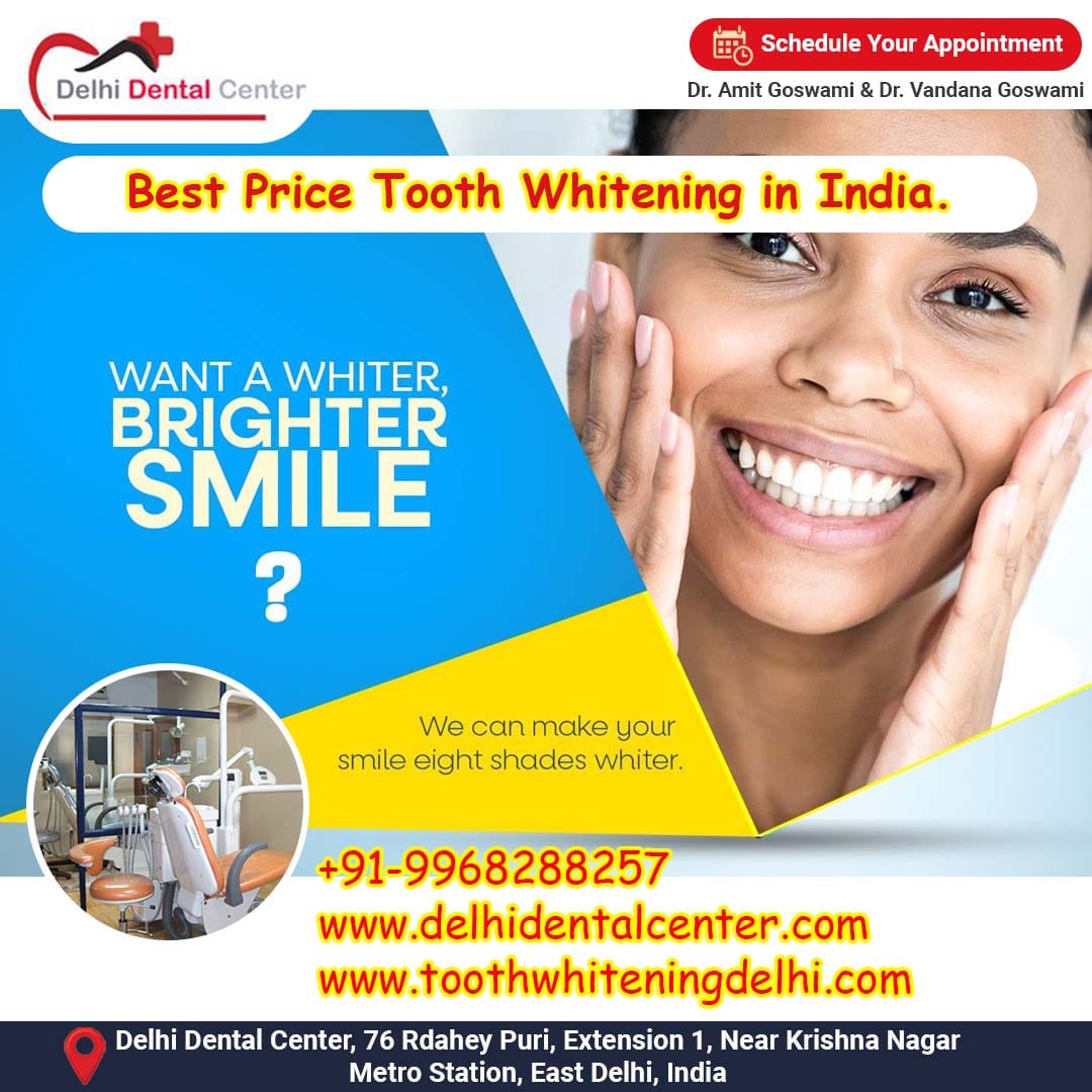 Best Price Tooth Whitening In India Teeth Whitening Clinic In India