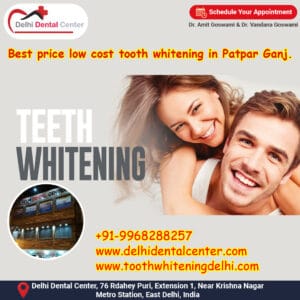 Best price low cost tooth whitening in Patpar Ganj