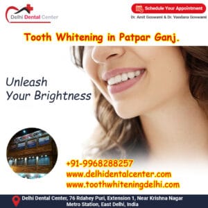 Teeth Whitening in Patpar Ganj